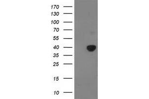 Image no. 1 for anti-Pyruvate Dehydrogenase (Lipoamide) alpha 1 (PDHA1) antibody (ABIN1500104) (PDHA1 anticorps)
