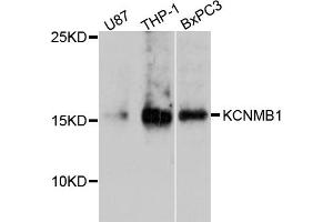 Western blot analysis of extracts of various cell lines, using KCNMB1 antibody (ABIN4904137) at 1:1000 dilution.