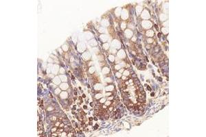 Immunohistochemistry analysis of paraffin-embedded mouse rectum using,RPL10 (ABIN7075428) at dilution of 1: 4000