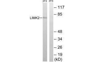 Western blot analysis of extracts from 3T3 cells, treated with PMA (125 ng/mL, 30 mins), using LIMK2 (Ab-283) antibody. (LIMK2 anticorps  (Ser283))