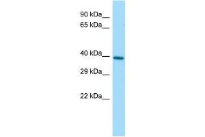 Host:  Rabbit  Target Name:  Pggt1b  Sample Type:  Rat Small Intestine lysates  Antibody Dilution:  1. (PGGT1B anticorps  (C-Term))