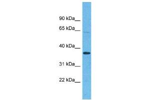 Western Blotting (WB) image for anti-Olfactory Receptor, Family 5, Subfamily H, Member 15 (OR5H15) (C-Term) antibody (ABIN2791757) (OR5H15 anticorps  (C-Term))