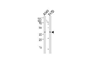 Western blot analysis of lysates from A549, T47D cell line (from left to right), using ERCC1 Antibody (C-term) (ABIN1882194 and ABIN2843349).
