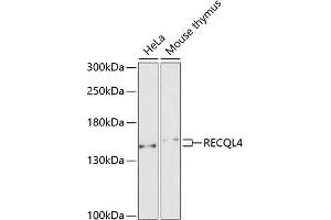 Western blot analysis of extracts of various cell lines, using RECQL4 antibody (ABIN6130663, ABIN6146846, ABIN6146847 and ABIN6222575) at 1:1000 dilution. (RECQL4 anticorps  (AA 231-330))