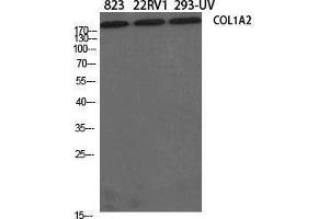 Western Blotting (WB) image for anti-Collagen, Type I, alpha 2 (COL1A2) (N-Term) antibody (ABIN3174478) (COL1A2 anticorps  (N-Term))