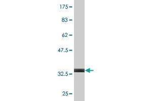 Western Blot detection against Immunogen (39. (RAMP3 anticorps  (AA 24-148))