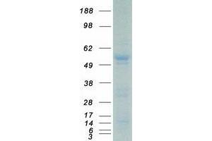 Validation with Western Blot