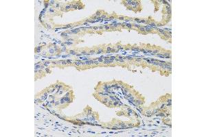 Immunohistochemistry of paraffin-embedded human prostate using CST3 antibody at dilution of 1:100 (40x lens). (CST3 anticorps)