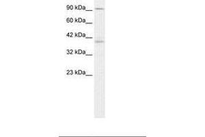 Image no. 2 for anti-Kinesin Family Member C2 (KIFC2) (AA 150-199) antibody (ABIN202931) (KIFC2 anticorps  (AA 150-199))