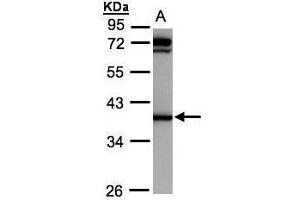 WB Image Sample(30 ug whole cell lysate) A:Raji , 10% SDS PAGE antibody diluted at 1:1000