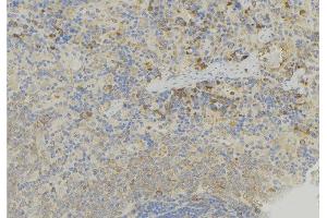 ABIN6272918 at 1/100 staining Human lymph node tissue by IHC-P. (GDI2 anticorps  (Internal Region))