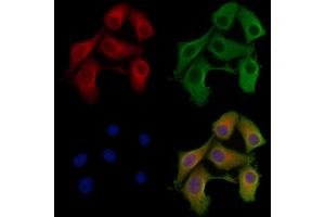 ABIN6257100 and ABIN6275625 staining Hela cells by IF/ICC.