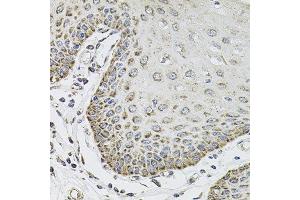 Immunohistochemistry of paraffin-embedded human esophagus using SDC2 antibody at dilution of 1:100 (x40 lens). (Syndecan 2 anticorps)