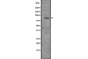 Western blot analysis of CENPI expression in Hela cell lysate,The lane on the left is treated with the antigen-specific peptide. (CENPI anticorps  (Internal Region))