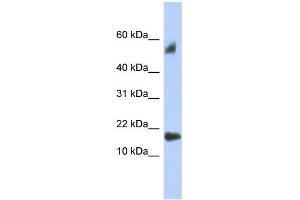WB Suggested Anti-FLJ35767 Antibody Titration: 0. (FLJ35767 (Middle Region) anticorps)