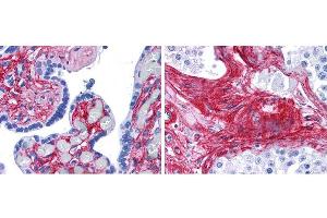 Immunohistochemistry of Rabbit anti-collagen VI antibody.