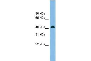WB Suggested Anti-ANKRD42 Antibody Titration:  0. (ANKRD42 anticorps  (N-Term))