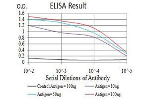 Black line: Control Antigen (100 ng),Purple line: Antigen (10 ng), Blue line: Antigen (50 ng), Red line:Antigen (100 ng)