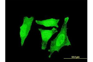 Immunofluorescence of monoclonal antibody to RGS3 on HeLa cell.