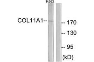 Western blot analysis of extracts from K562 cells, using Collagen XI alpha1 Antibody. (COL11A1 anticorps  (AA 581-630))