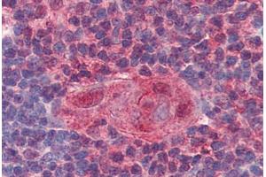 Human Thymus (formalin-fixed, paraffin-embedded) stained with UNG antibody ABIN364332 at 10 ug/ml followed by biotinylated anti-mouse IgG secondary antibody ABIN481714, alkaline phosphatase-streptavidin and chromogen. (UNG anticorps  (AA 1-313))