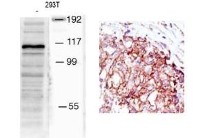 Image no. 1 for anti-Mindbomb E3 Ubiquitin Protein Ligase 1 (MIB1) (N-Term) antibody (ABIN357602)