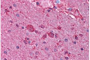 Human Brain, Cortex (formalin-fixed, paraffin-embedded) stained with CHRNB3 antibody ABIN214743 at 2.