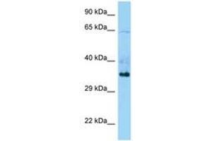 Image no. 1 for anti-Tripartite Motif Containing 44 (TRIM44) (C-Term) antibody (ABIN6748290) (TRIM44 anticorps  (C-Term))
