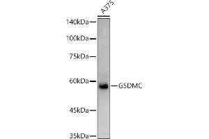 Western blot analysis of extracts of  cells, using GSDMC antibody (ABIN7268463) at 1:1000 dilution. (MLZE anticorps  (AA 1-100))