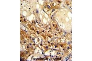 Immunohistochemistry (IHC) image for anti-Cytochrome P450, Family 20, Subfamily A, Polypeptide 1 (CYP20A1) antibody (ABIN3003220) (CYP20A1 anticorps)
