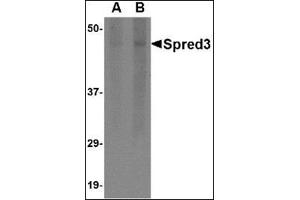 Western blot analysis of Spred3 in human brain tissue lysate with this product at (A) 2 and (B) 4 μg/ml. (SPRED3 anticorps  (Center))