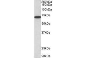 AP31951PU-N HDAC1 antibody staining of HeLa lysate at 0. (HDAC1 anticorps  (C-Term))