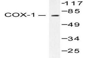 Image no. 2 for anti-Prostaglandin-Endoperoxide Synthase 1 (Prostaglandin G/H Synthase and Cyclooxygenase) (PTGS1) (pSer585) antibody (ABIN265370)