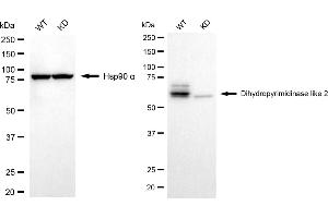 Western blotting analysis using dihydropyrimidinase like 2 antibody (ABIN7798337).