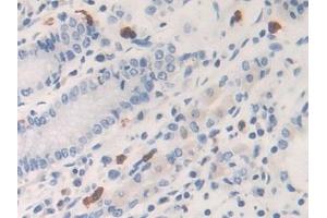 Detection of KLK6 in Human Stomach Tissue using Polyclonal Antibody to Kallikrein 6 (KLK6)