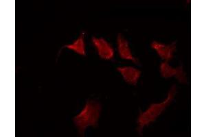 ABIN6267503 staining LOVO by IF/ICC.