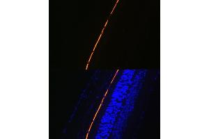 Immunofluorescence analysis of mouse eye using RPE65 Rabbit mAb (ABIN7269933) at dilution of 1:100 (40x lens). (RPE65 anticorps)