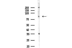 Western blot analysis of lysates from HUVEC cells, using LRSAM1 Antibody at 1/1000 dilution.