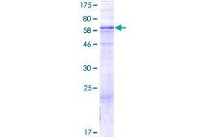 Image no. 1 for Glycosyltransferase-Like Domain Containing 1 (GTDC1) (AA 1-373) protein (GST tag) (ABIN1306116)