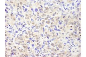 Immunohistochemistry (IHC) image for anti-Casein beta (CSN2) (AA 1-50) antibody (ABIN7448492) (CSN2 anticorps  (AA 1-50))