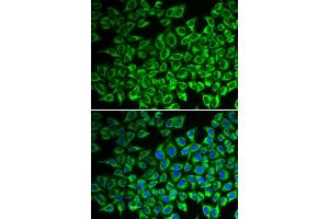 Immunofluorescence analysis of A549 cells using IL12RB1 antibody. (IL12RB1 anticorps)