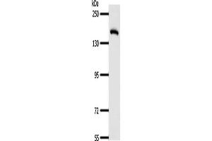Gel: 8 % SDS-PAGE, Lysate: 40 μg, Lane: Human fetal lung tissue, Primary antibody: ABIN7189710(AFF2 Antibody) at dilution 1/400, Secondary antibody: Goat anti rabbit IgG at 1/8000 dilution, Exposure time: 1 minute (AFF2 anticorps)