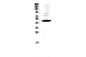 Western blot analysis of CCR1 using anti-CCR1 antibody .