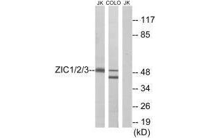 Western blot analysis of extracts from Jurkat cells and COLO cells, using ZIC1/2/3 antibody. (ZIC1 anticorps)