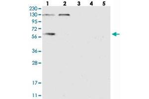 Western blot analysis of Lane 1: RT-4, Lane 2: U-251 MG, Lane 3: Human Plasma, Lane 4: Liver, Lane 5: Tonsil with DYNC1LI1 polyclonal antibody  at 1:250-1:500 dilution. (DYNC1LI1 anticorps)