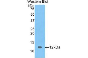 Detection of Recombinant PRAME, Human using Polyclonal Antibody to Preferentially Expressed Antigen In Melanoma (PRAME) (PRAME anticorps  (AA 416-502))