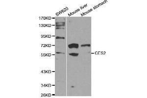 Western blot analysis of extracts of various cell lines, using CES2 antibody. (CES2 anticorps  (AA 310-410))