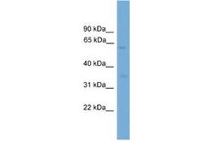 Image no. 1 for anti-Major Facilitator Superfamily Domain Containing 8 (MFSD8) (AA 351-400) antibody (ABIN6745584) (MFSD8 anticorps  (AA 351-400))