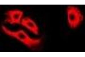 Immunofluorescent analysis of ETFA staining in A549 cells. (ETFA anticorps)