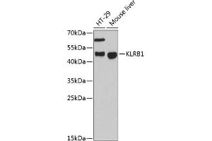 Western blot analysis of extracts of various cell lines, using KLRB1 antibody (ABIN6130055, ABIN6142970, ABIN6142972 and ABIN6222669) at 1:3000 dilution.